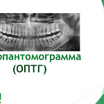  Ортопантомограмма (ОПТГ)