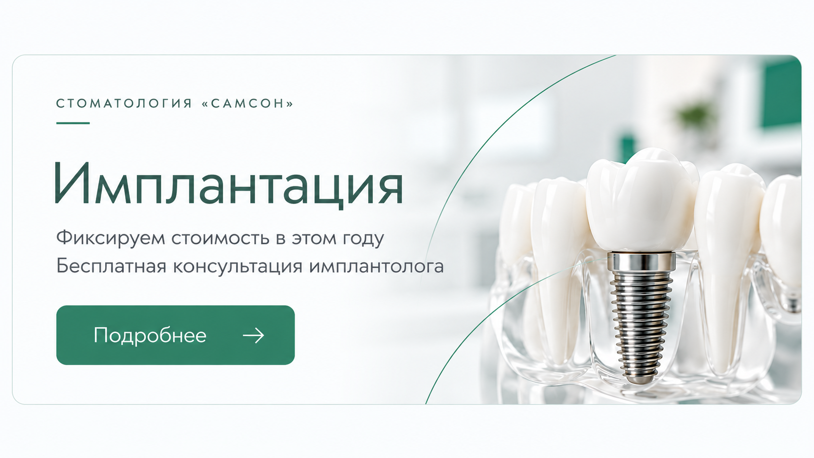 Если нужна имплантация! 