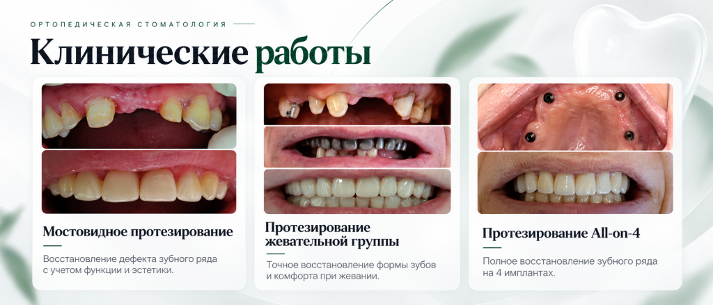 несъемное протезирование