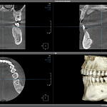 КТ Компьютерная томография челюстно-лицевой области 